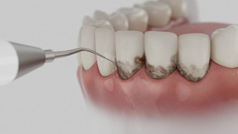Trusted Tooth Extraction service in Orangeburg, SC - Dentist Open Now